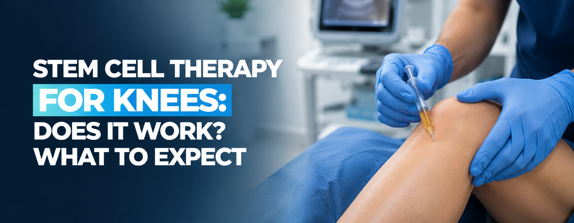 Stem Cell Therapy for Knees Does It Work What to Expect
